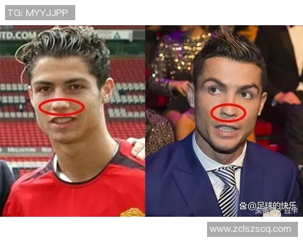 足球明星整容真相揭秘他们的外貌变化背后的故事 足球明星整容真相揭秘他们的外貌变化背后的故事